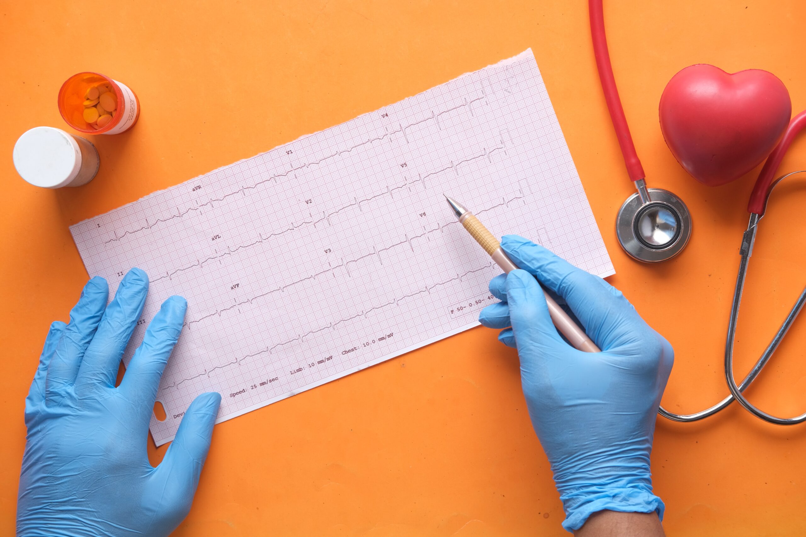 Electrocardiogramas en la Medicina Deportiva: Todo lo que Necesitas Saber
