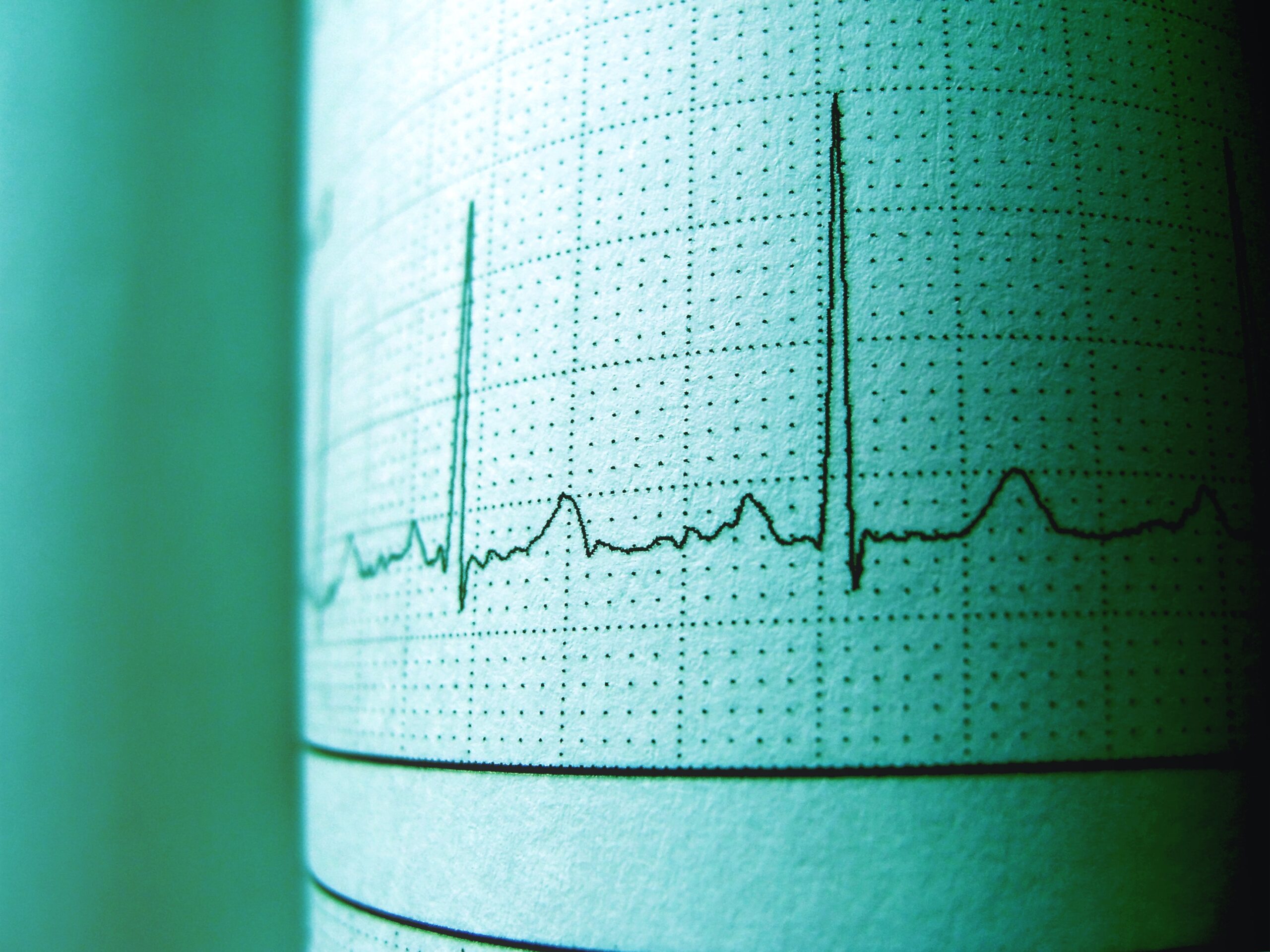 Como calcular la frecuencia cardíaca en reposo